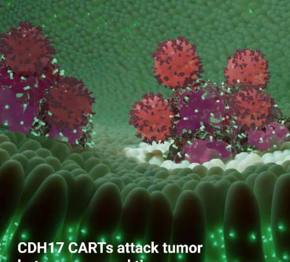 Penn-Developed CAR T Cells Suppress GI Solid Tumor Cells, Without Toxicity to Healthy Tissue, in Preclinical Research