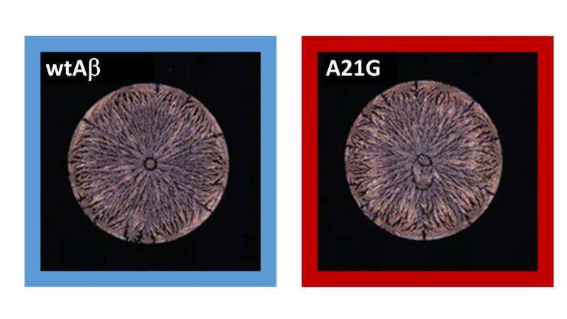 Peptide “fingerprint” enables earlier diagnosis of Alzheimer’s disease
