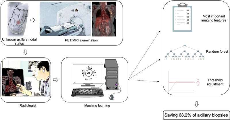 PET/MRI Machine Learning Model Can Eliminate Sentinel Lymph Node Biopsy in Majority of Breast Cancer Patients