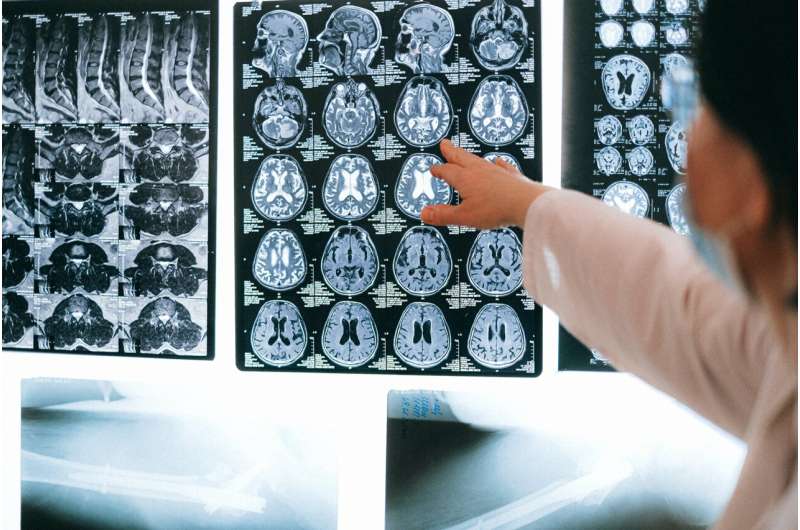 Portuguese researchers are studying the causes of sudden death in epilepsy