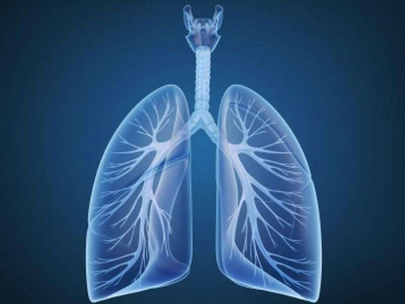 Progress on lung cancer drives overall decline in U.S. cancer deaths