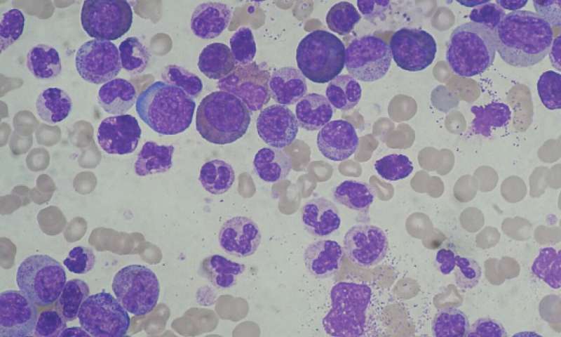 Promising approach to mitigate complications of leukemia treatment