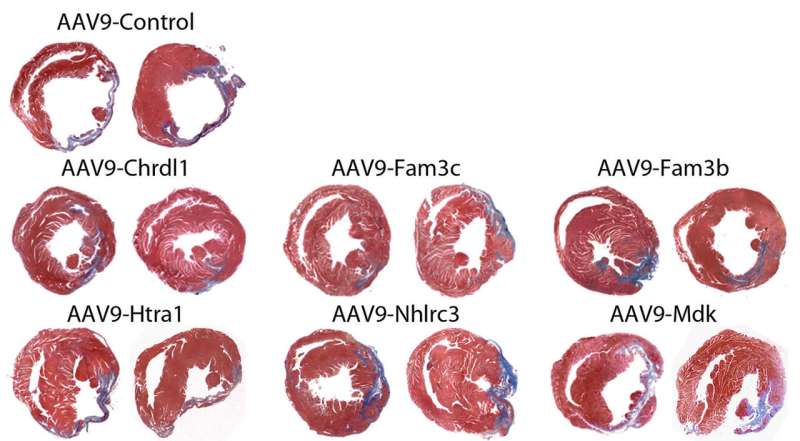 蛋白质库筛选揭示了防止小鼠心脏病发作的因素