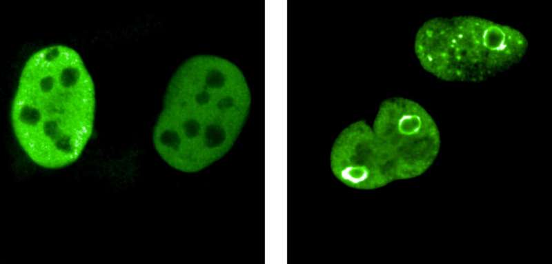 Protein spheres protect the genome of cancer cells