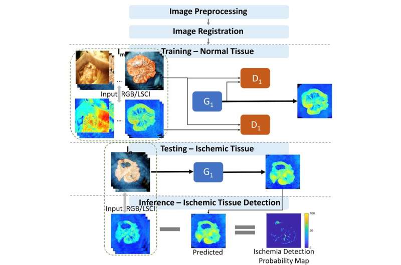 Quantitative diagnosis of bowel ischemia with deep learning