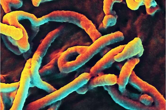 تشخیص سریع ابولا ممکن است با فناوری جدید امکان پذیر باشد