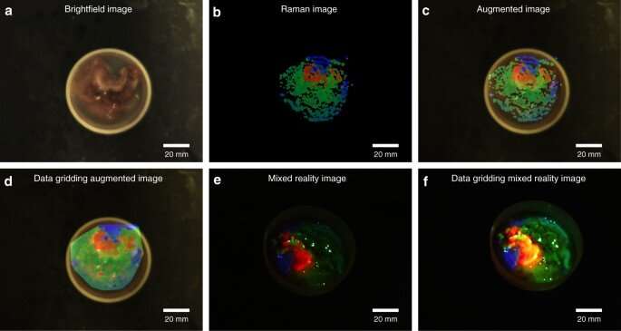 Real-time molecular imaging of near-surface tissue using Raman spectroscopy