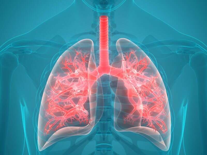 Recommendations updated for idiopathic pulmonary fibrosis