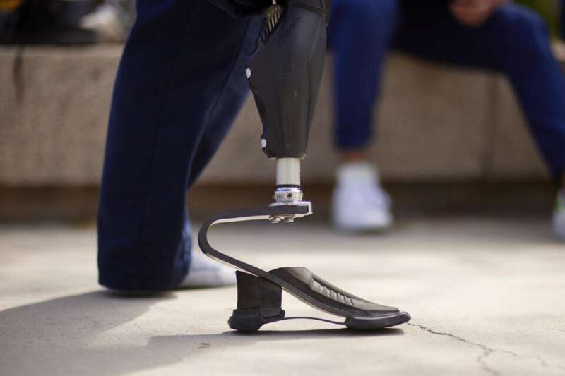 Research advances rehabilitation for those living with artificial limbs