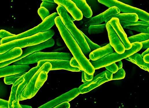 Research team finds that tuberculosis induces premature cellular aging
