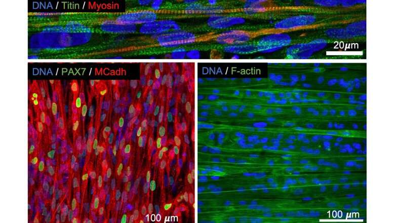 Researchers create synthetic scaffold to help grow lab muscle tissue