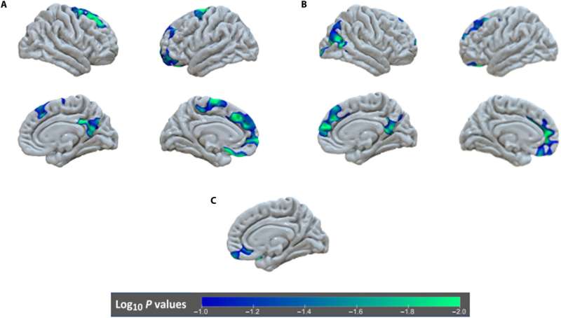 Researchers detect early deprivation continues to affect brain development well into adolescence