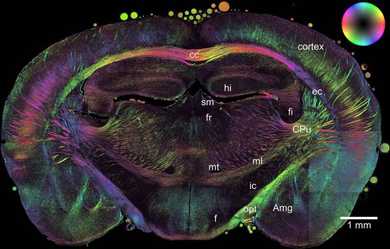 Researchers develop new imaging method to map alterations in the brain