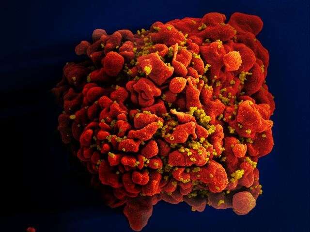 Researchers document third known case of HIV remission involving stem cell transplant