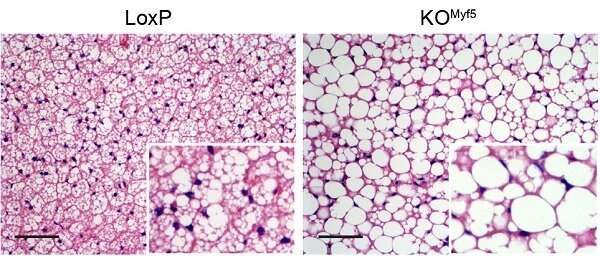 Researchers find key mechanism for brown adipose tissue formation to prevent obesity