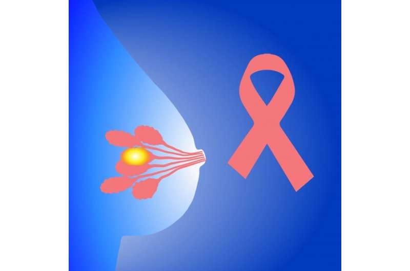 Researchers identify a regulator of breast cancer development