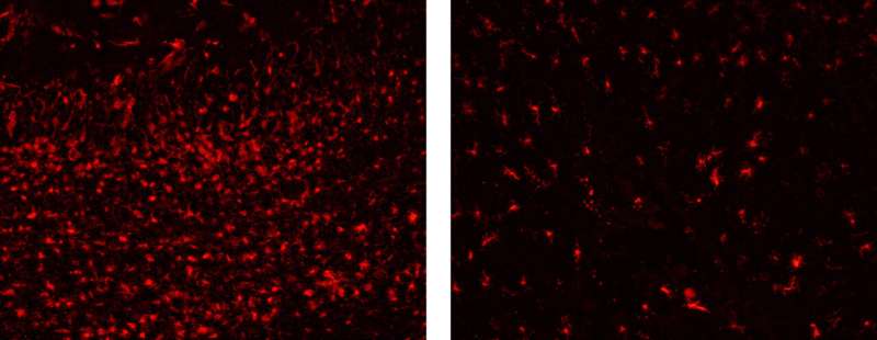 Researchers identify cells causing neuronal death in a mitochondrial disease animal model