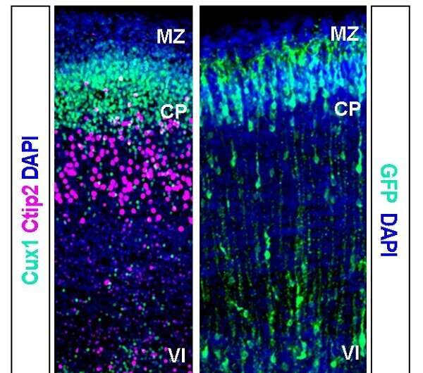 Researchers identify new model of cerebral cortex development linked to reelin protein expression