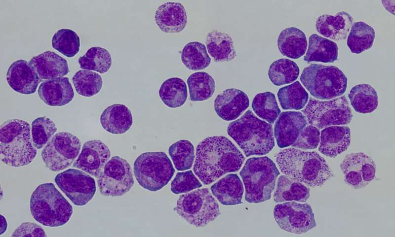 Researchers identify therapeutic target for aggressive blood cancer
