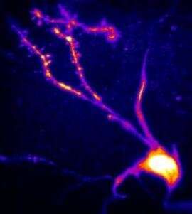 Researchers observe memory formation in real time