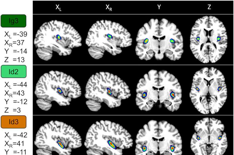 Researchers of the Human Brain Project identify seven new areas in the insular cortex