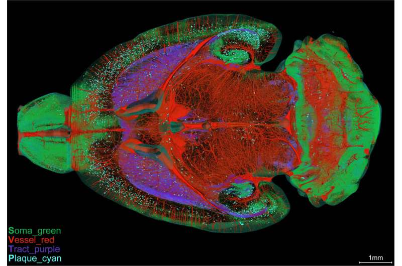 研究人员在患有阿尔茨海默病的小鼠身上重建了多个结构的全脑全景图