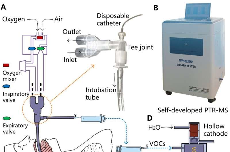 Researchers screen for ventilator-associated pneumonia infection through breath test