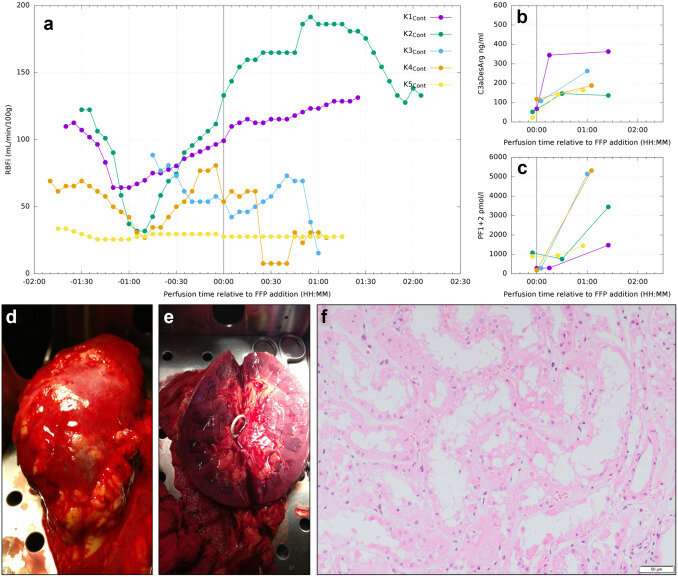 Researchers successfully model antibody-mediated transplant rejection in human kidneys