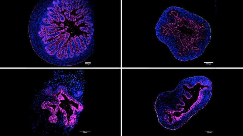 Researchers successfully generate organoids in suspension, offering a new opportunity for investigators