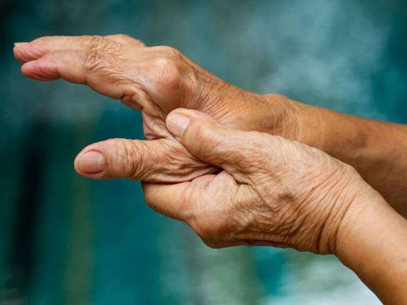 Rheumatoid arthritis linked to peripheral artery disease