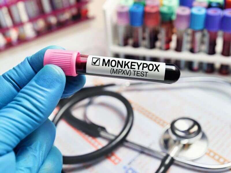 Risk of monkeypox transmission low in health care settings