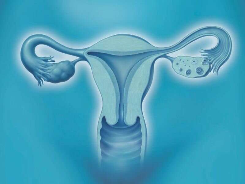 Risk of uterine diseases, cancers up with tamoxifen treatment