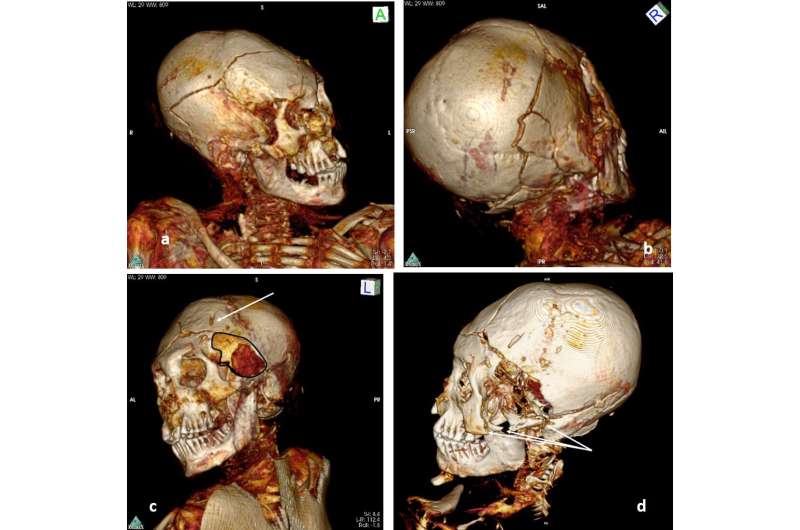 Scientific 'detective work' reveals that South American mummies were brutally murdered
