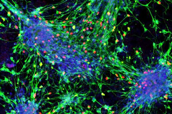Scientists develop blueprint for turning stem cells into sensory interneurons