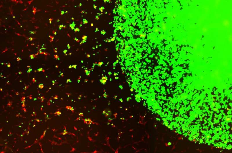 科学家开发出“现成的”工程干细胞来治疗侵袭性脑癌