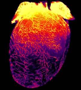 Scientists Gain Unexpected Insight of Lymphatic Vessels in the Heart