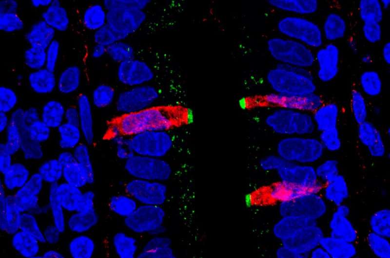 Scientists map entire human gut at single cell resolution