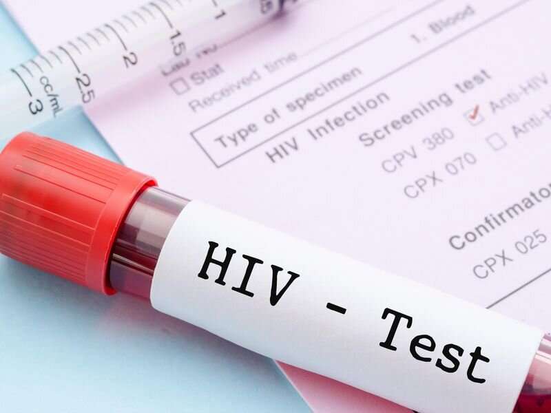Scientists may be closer to effective HIV vaccine
