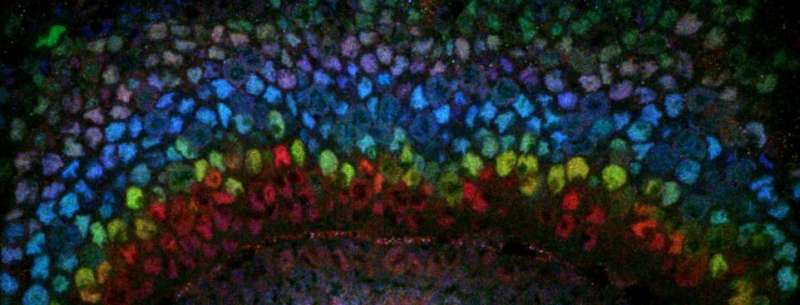 Scientists pinpoint what makes brain cells develop in a specific order