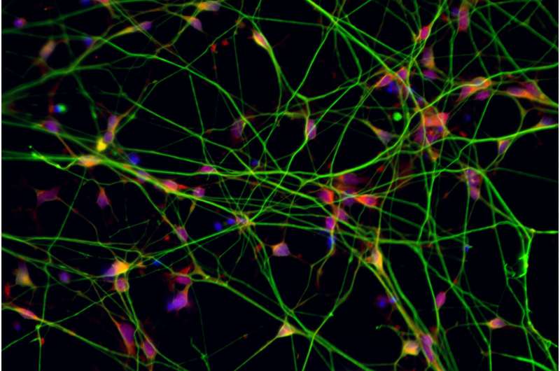 科学家认为一种肽可以阻止和逆转对神经细胞的损伤