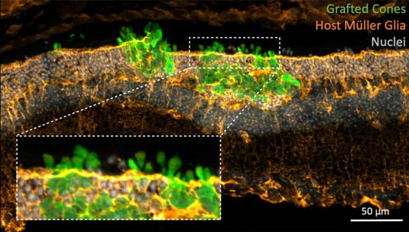 Scientists transplant human photoreceptors to successfully recover daylight perception in mice