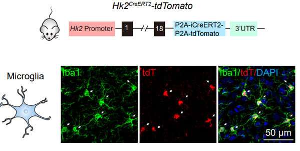 Scientists uncover hexokinase 2's role in microglial activity