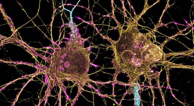 Scientists uncover new targets for treating Parkinson's disease