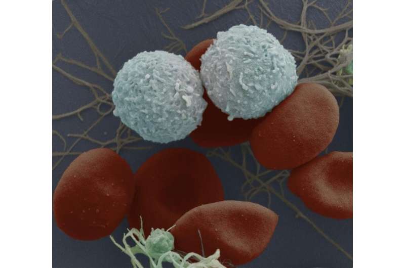 Scientists uncover new mark for targeted leukaemia treatment