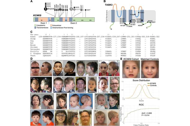 Scientists unravel mystery of rare neurodevelopmental disorder, provide definitive diagnoses to 21 families worldwide