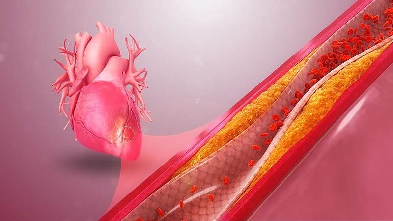 Scientists validate a low-risk diagnostic test for coronary artery disease