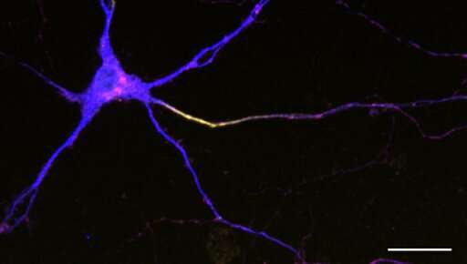 Secret of neuron's shape revealed in study of worms, rodents, people