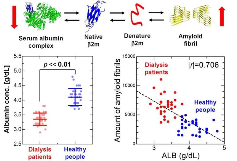 Serum albumin could prevent amyloid fibril formation in dialysis patients