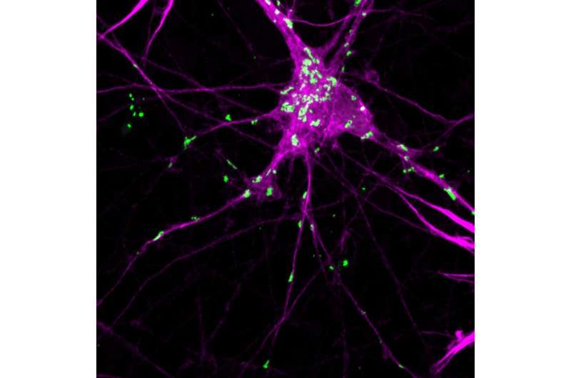 Shining a light on protein aggregation in Parkinson's disease