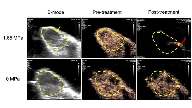 Sidekick microbubbles carry anti-cancer drugs, damage tumor vessels #ASA182